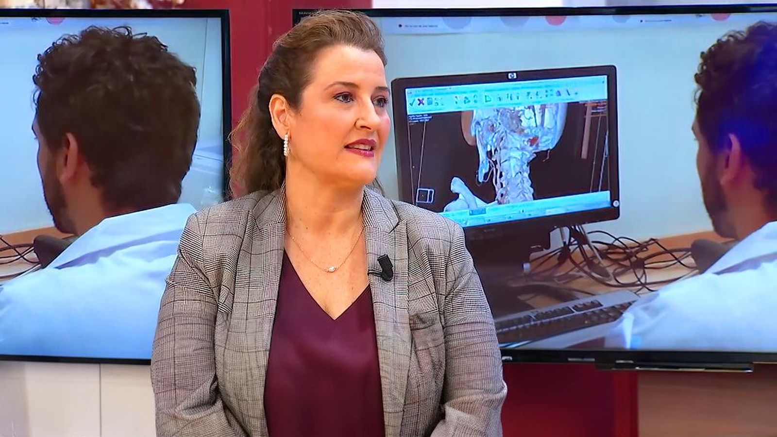 Conocemos los síntomas y los factores de riesgo de sufrir un ictus